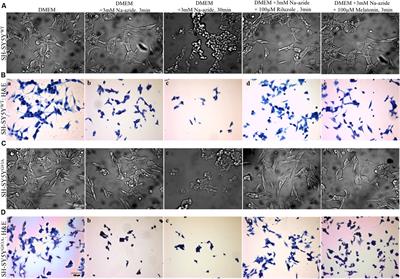 Riluzole But Not Melatonin Ameliorates Acute Motor Neuron Degeneration and Moderately Inhibits SOD1-Mediated Excitotoxicity Induced Disrupted Mitochondrial Ca2+ Signaling in Amyotrophic Lateral Sclerosis